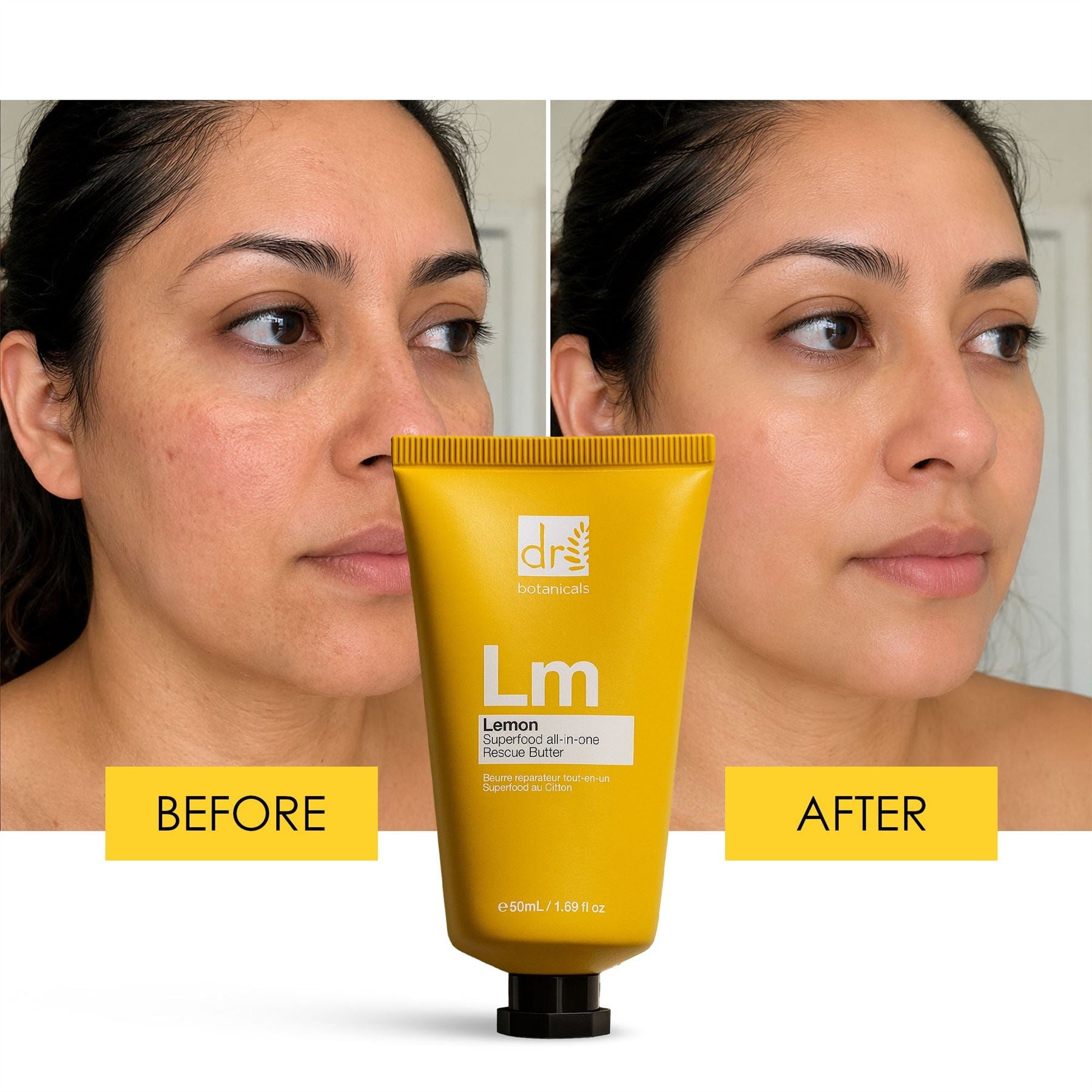RDB Lemon Superfood all-in-one  Rescue Butter 50ml Trio Set